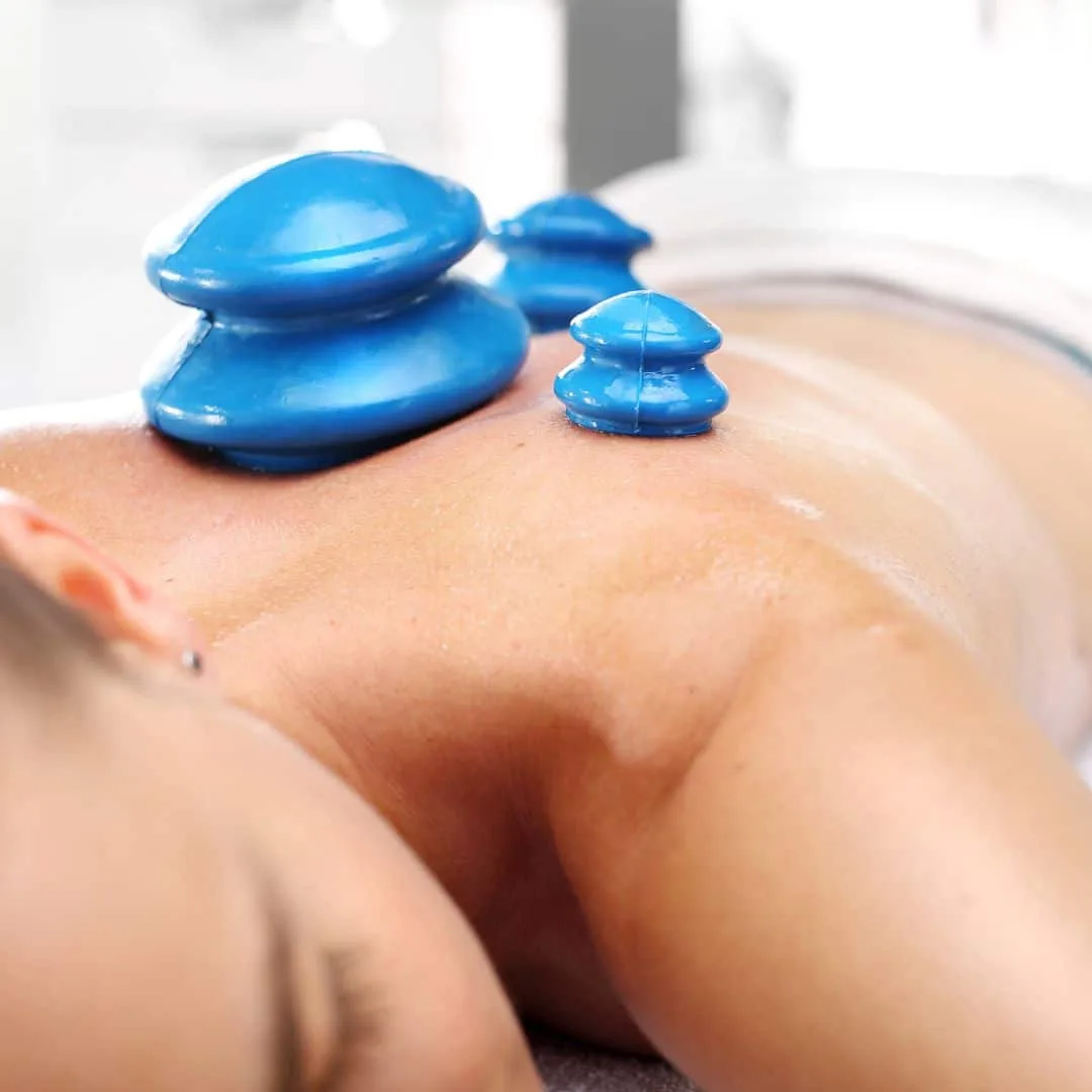 Cupping therapy cups applied along the back