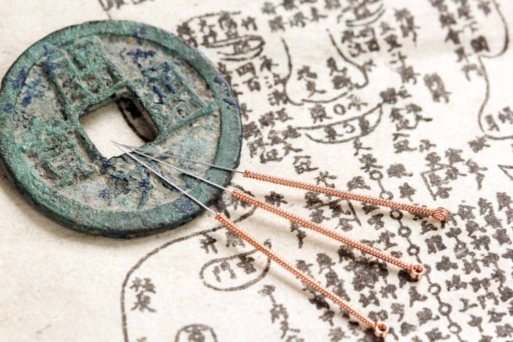 Acupuncture… What’s the Point?