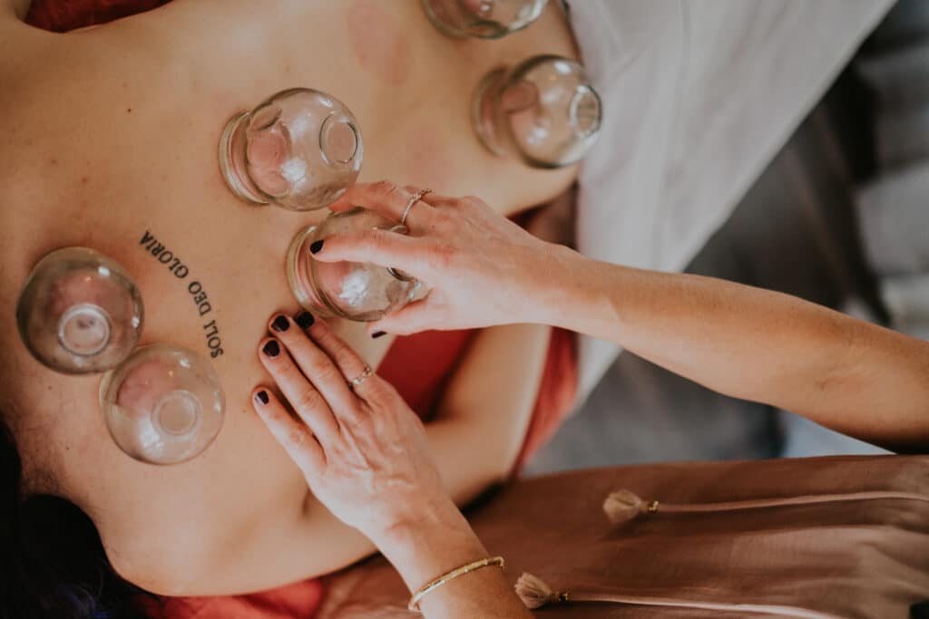 Cupping Therapy