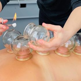 briana cupping fire